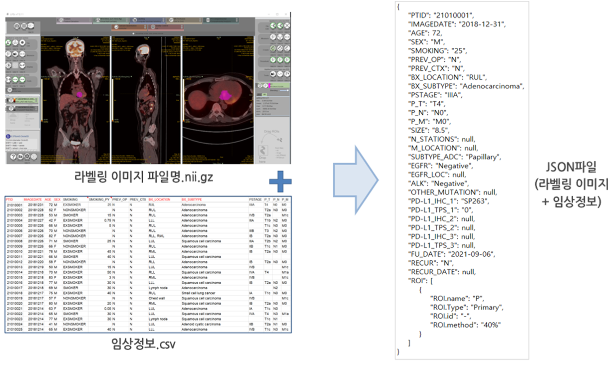 핵의학영상(PET) 이미지-데이터 포맷_3