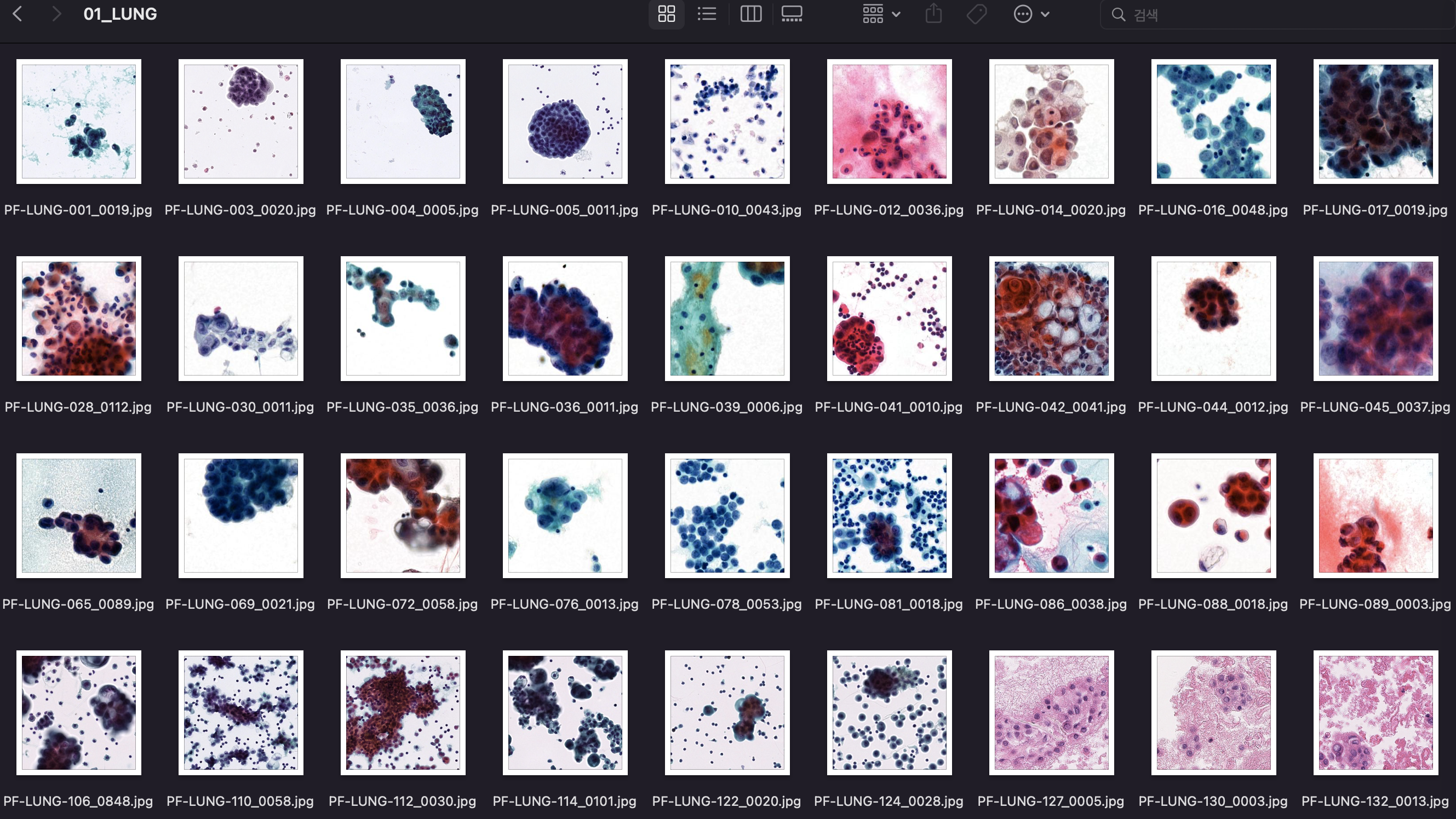 체액 내 세포검사 이미지-데이터 포맷_1_jpg + csv file (어노테이션파일)