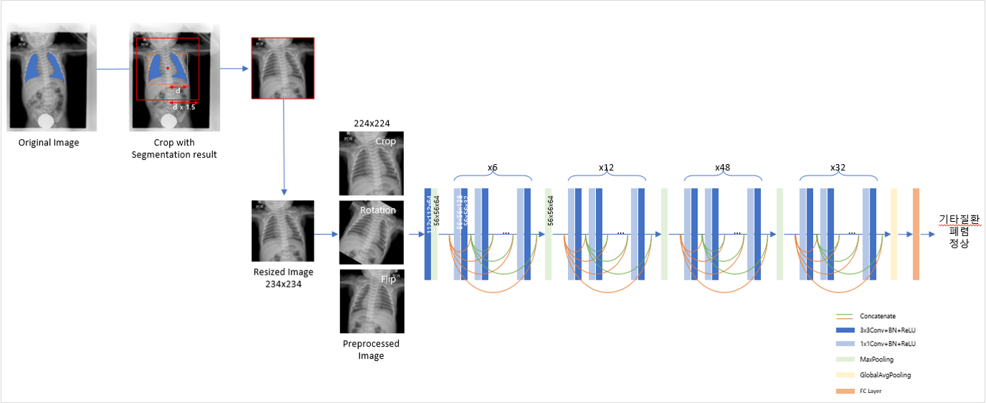 소아 흉부 이미지 데이터-활용모델_1_흉부 질환분류 모델 : DenseNet121