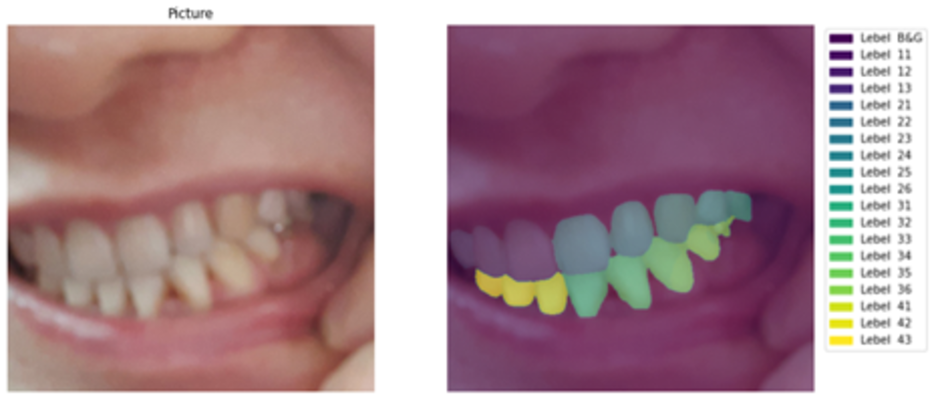 치아 번호 생성 및 분류 이미지