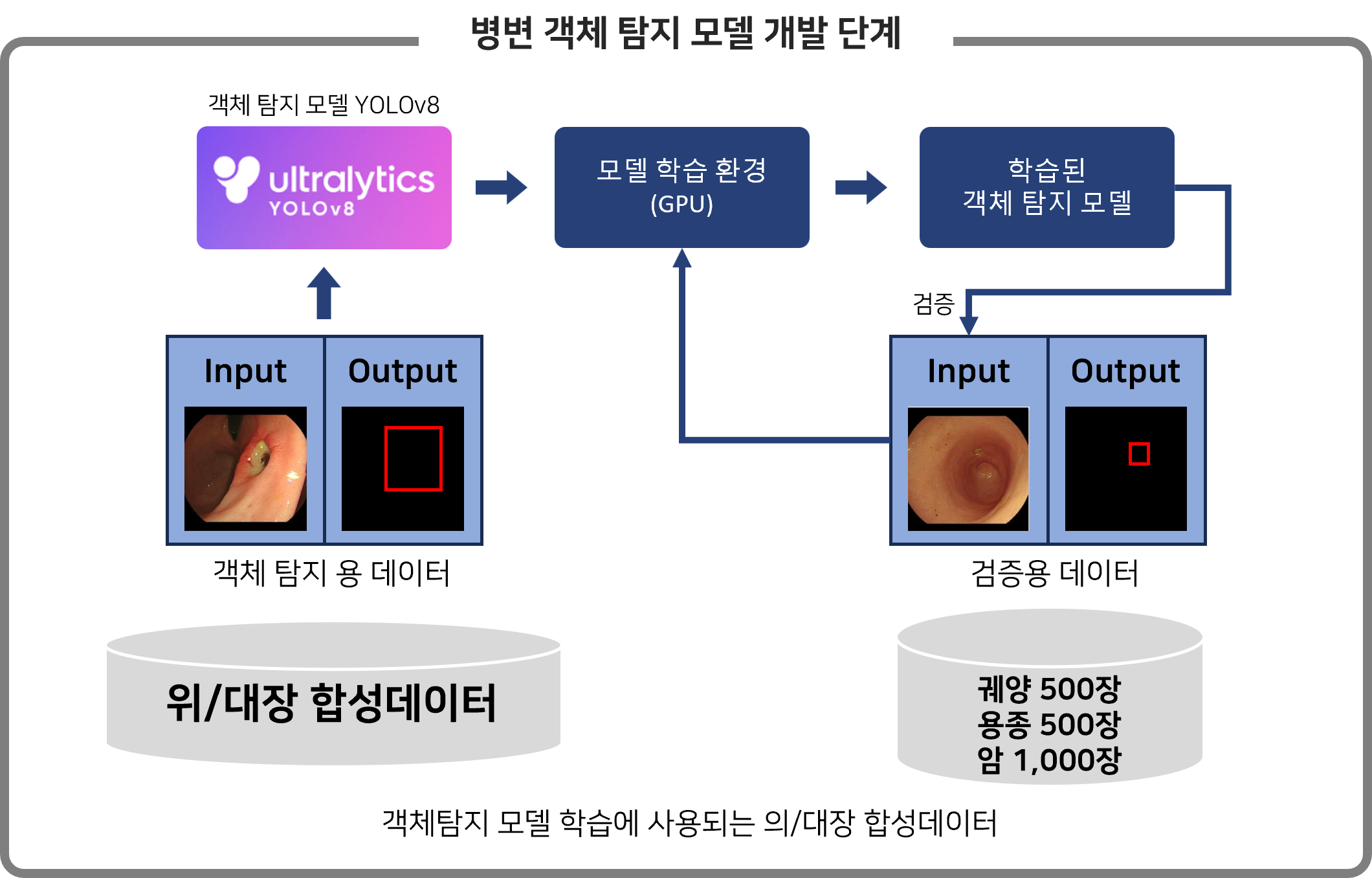 병변 객체 탐지 모델 개발 단계 