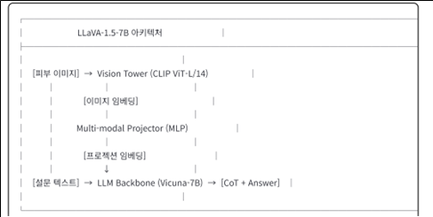 모델 아키텍처