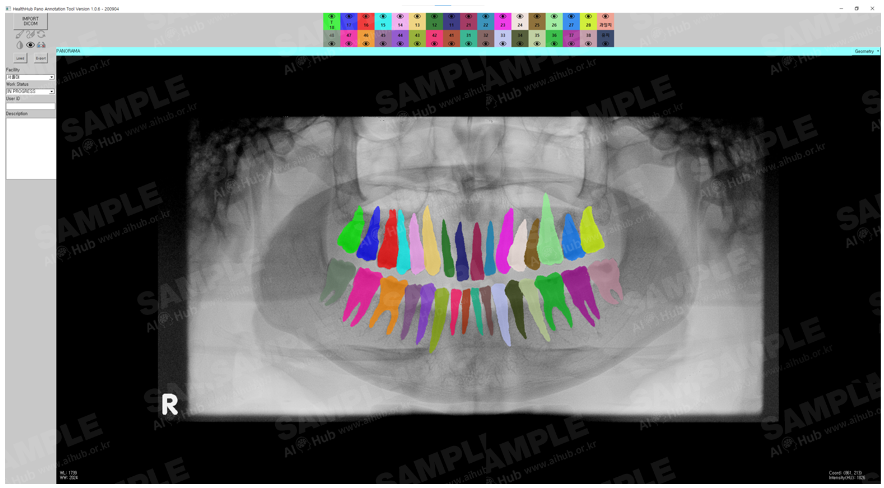 구강악 2D·3D 이미지-데이터 구조-[BIN] 치아번호 부여 및 세그멘테이션 데이터