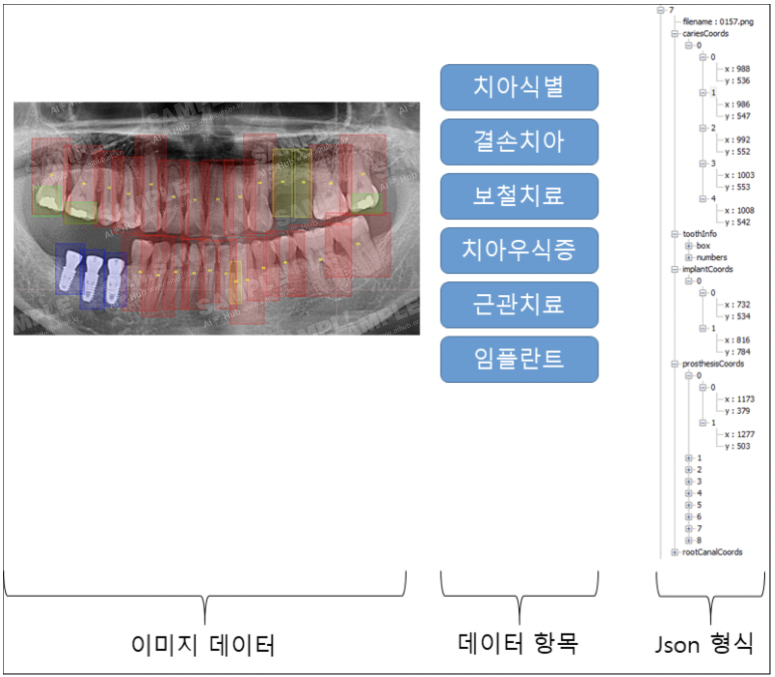 치과 진환 진단 의료 영상-데이터 포맷_1